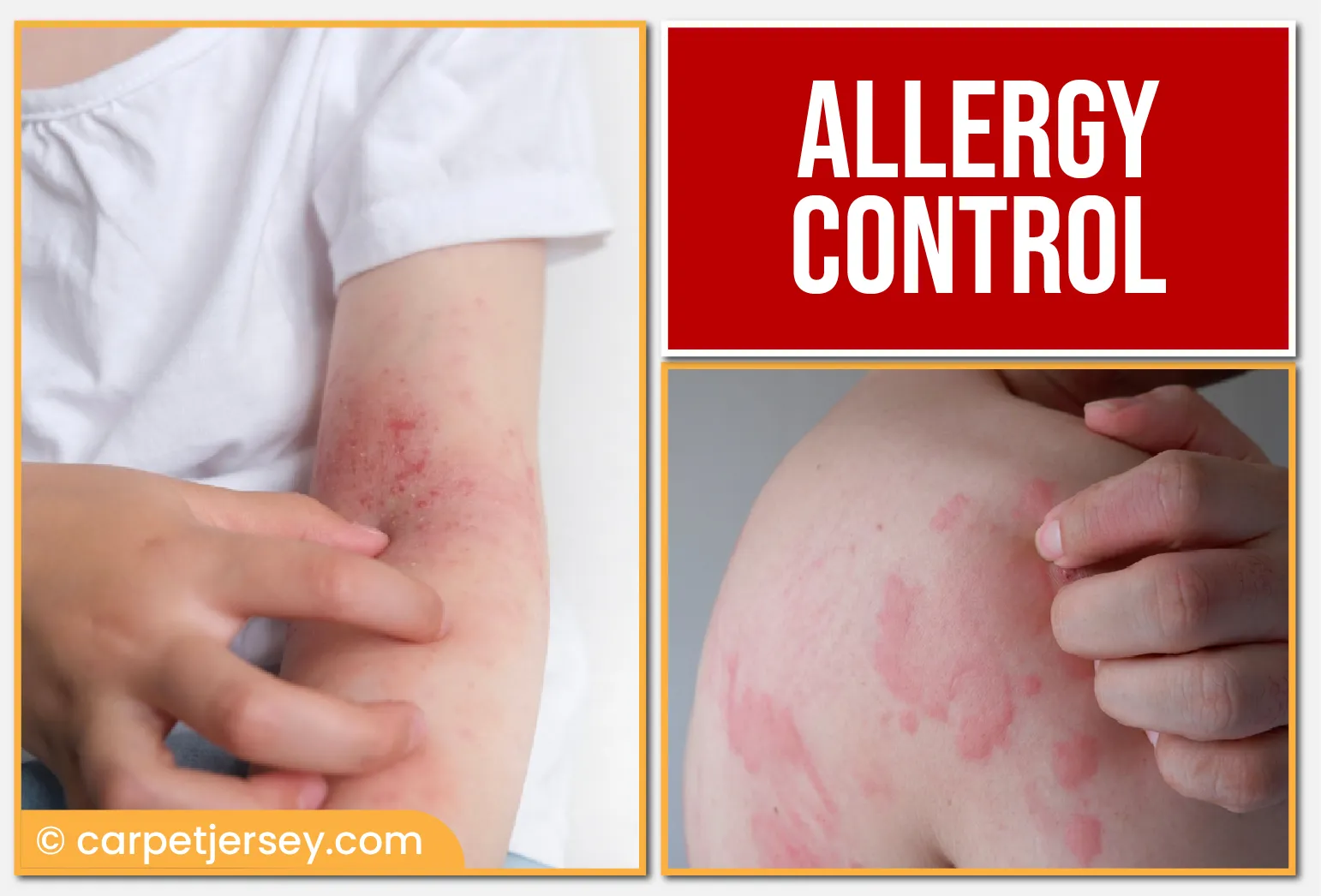 Allergy Control